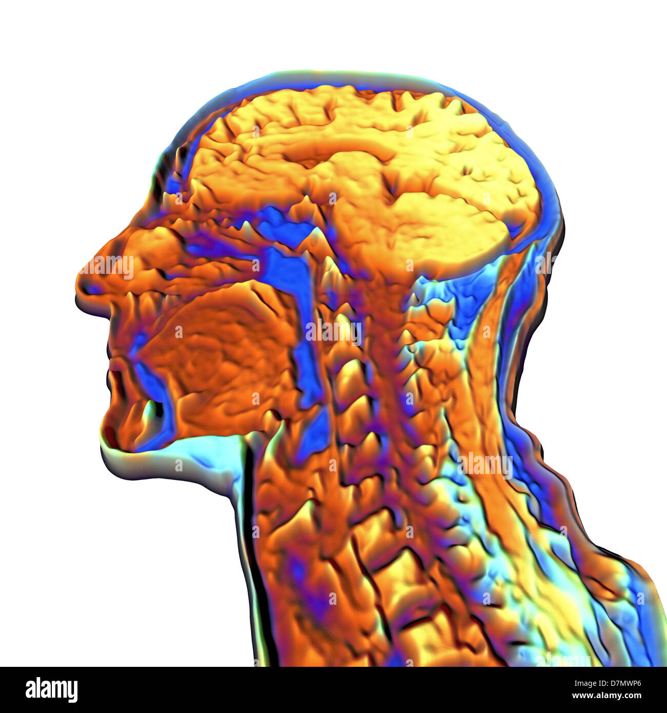 Colore scansione MRI della testa umana Foto Stock