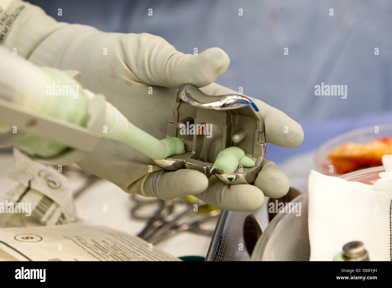 La sostituzione totale del ginocchio il funzionamento in un teatro ospedaliero Foto Stock