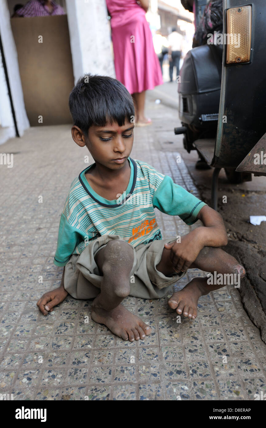Giovane mendicante indiano con gravemente deformato arti Foto Stock