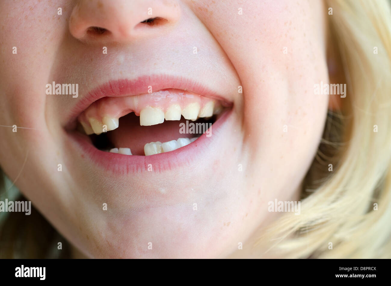 Latte mancante dente dalla bocca di Childs Foto Stock