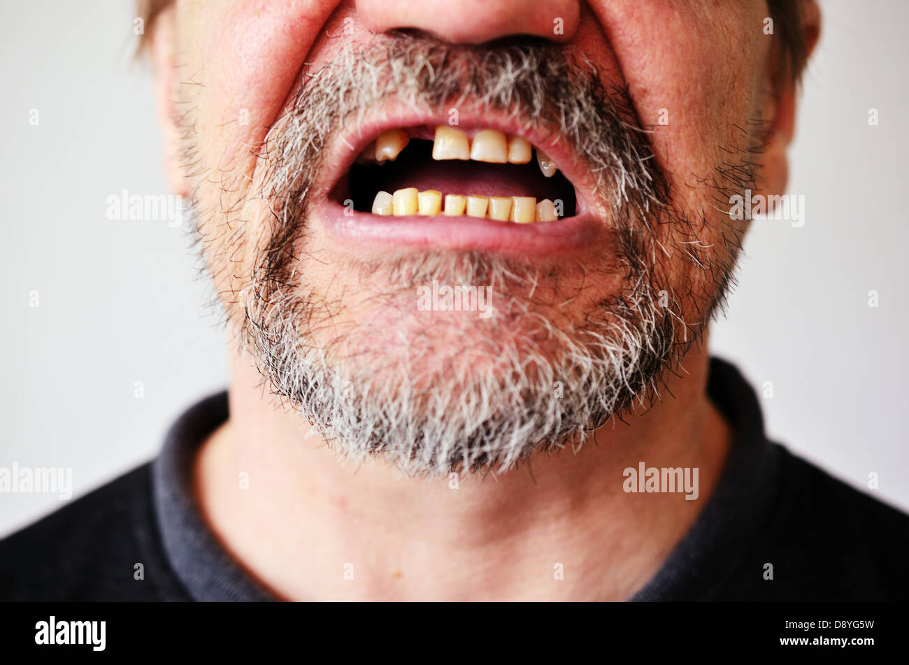Parte di un uomo di faccia con un aperto bocca priva di denti Foto Stock