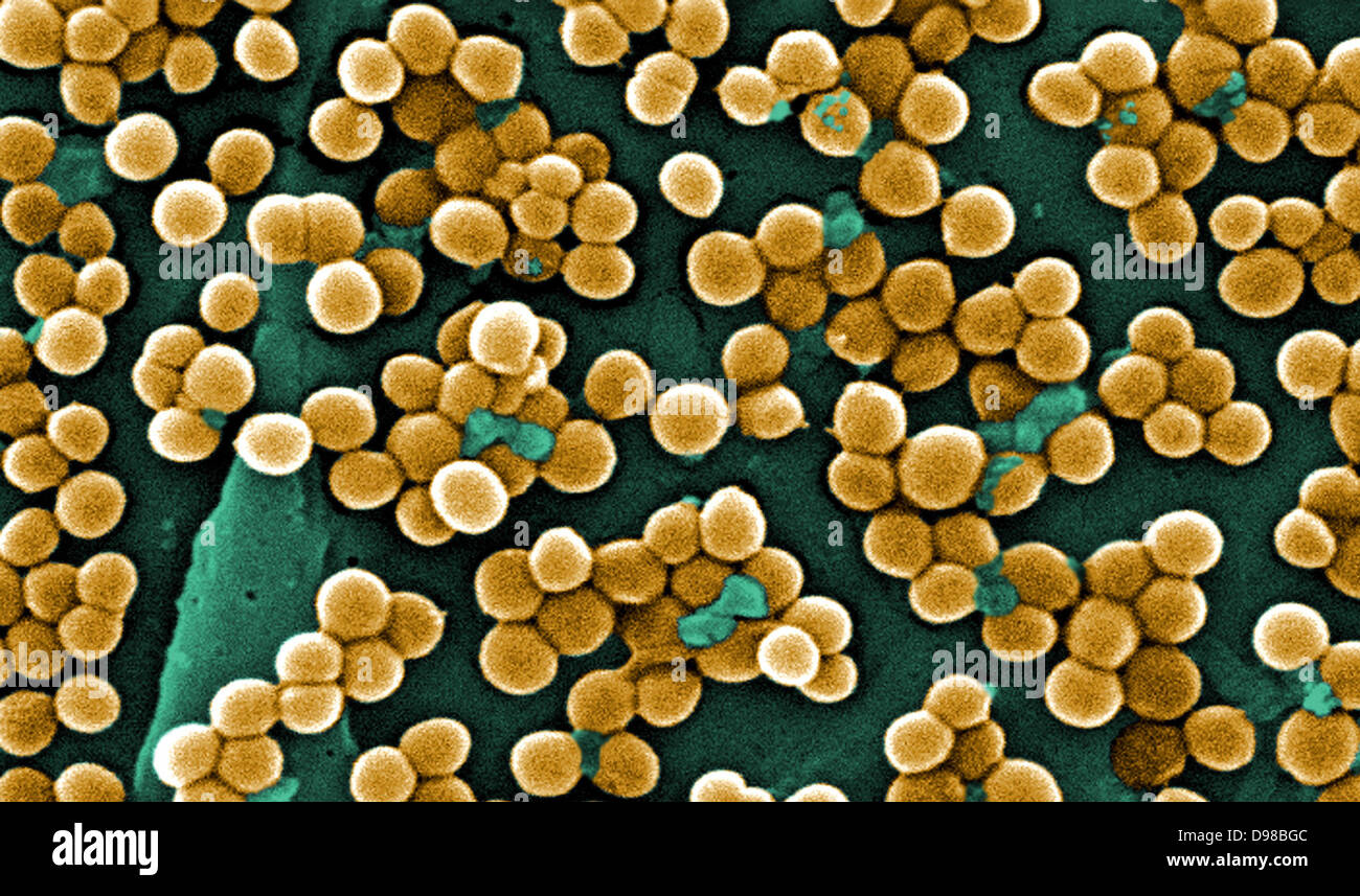 Virus MRSA sotto un microscopio Foto Stock