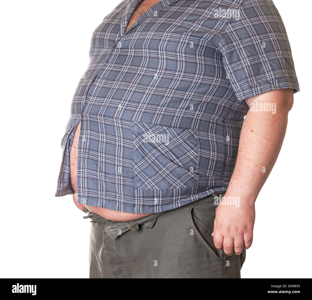 Fat Man con una grande pancia, close-up di una parte del corpo Foto Stock