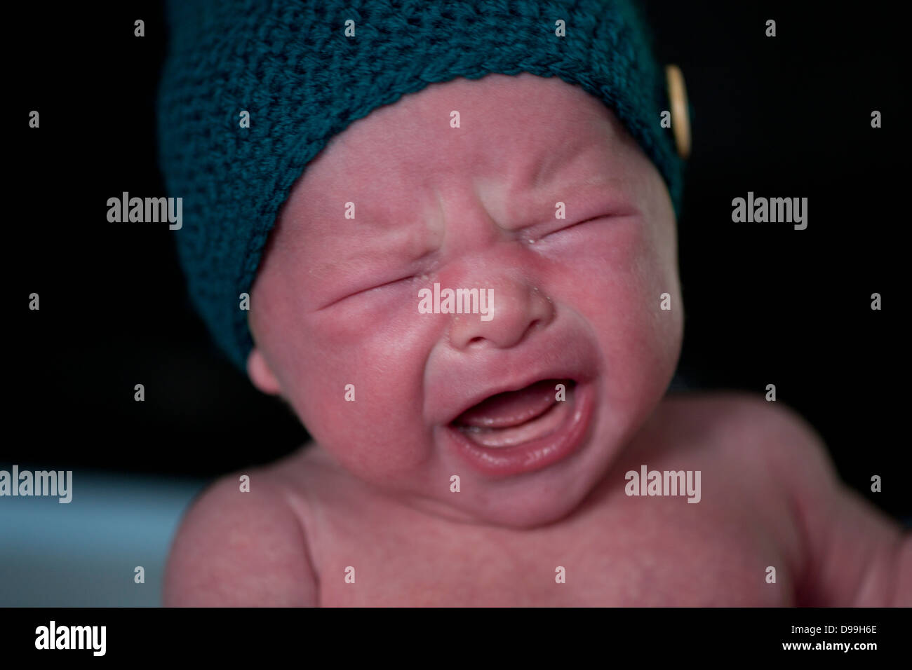 Rosso di fronte neonato sconvolto e pianto Foto Stock