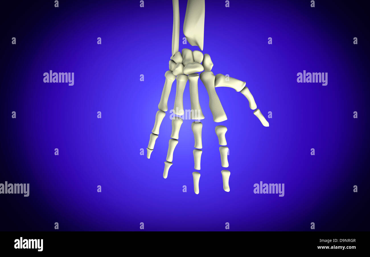 Immagine concettuale di ossa in mano umana. Foto Stock
