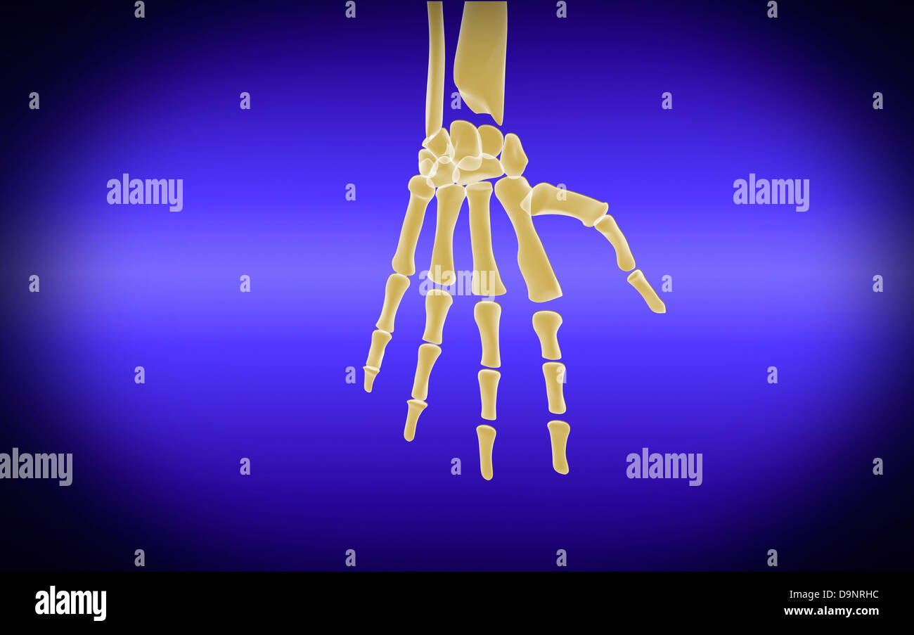 Immagine concettuale di ossa in mano umana. Foto Stock