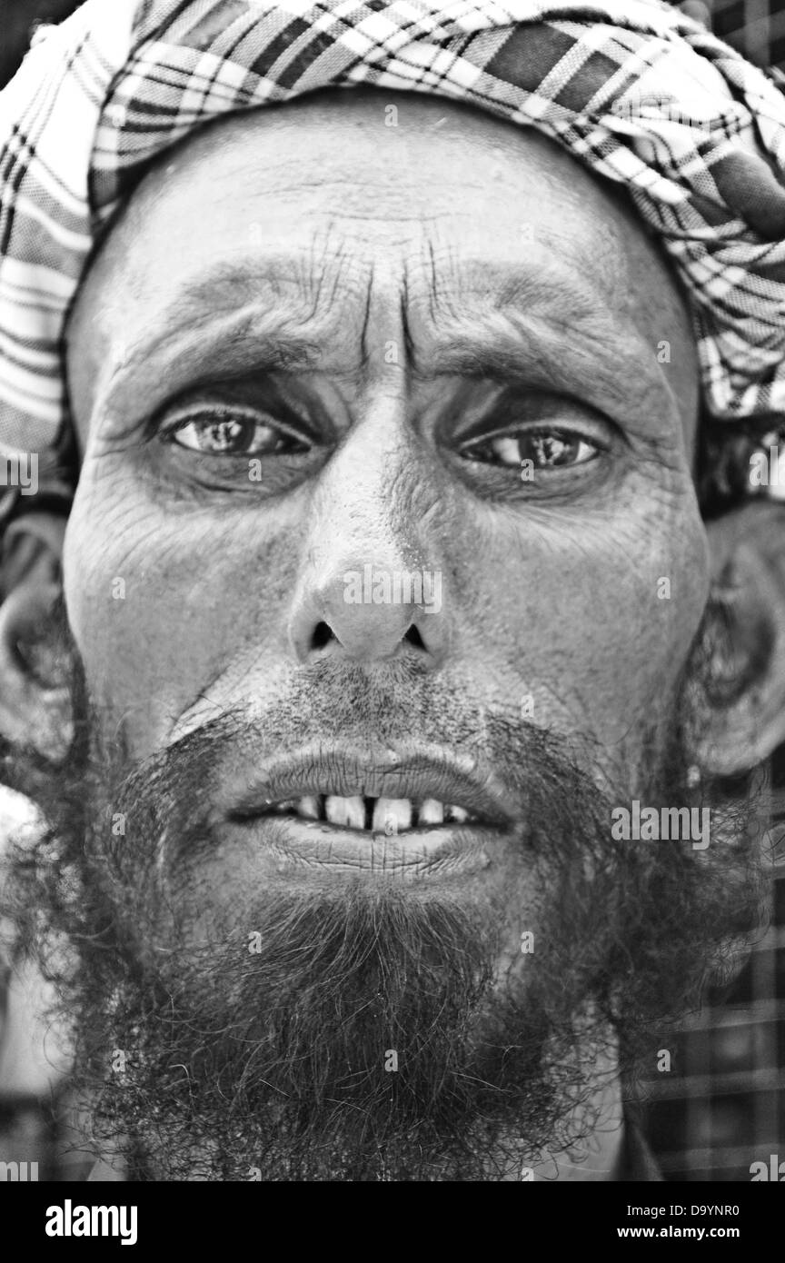 Per i rifugiati afghani,, barba, denti di ingranaggio di testa, rughe, faccia ossee, indiano, Kashmir India, povero e la povertà Foto Stock