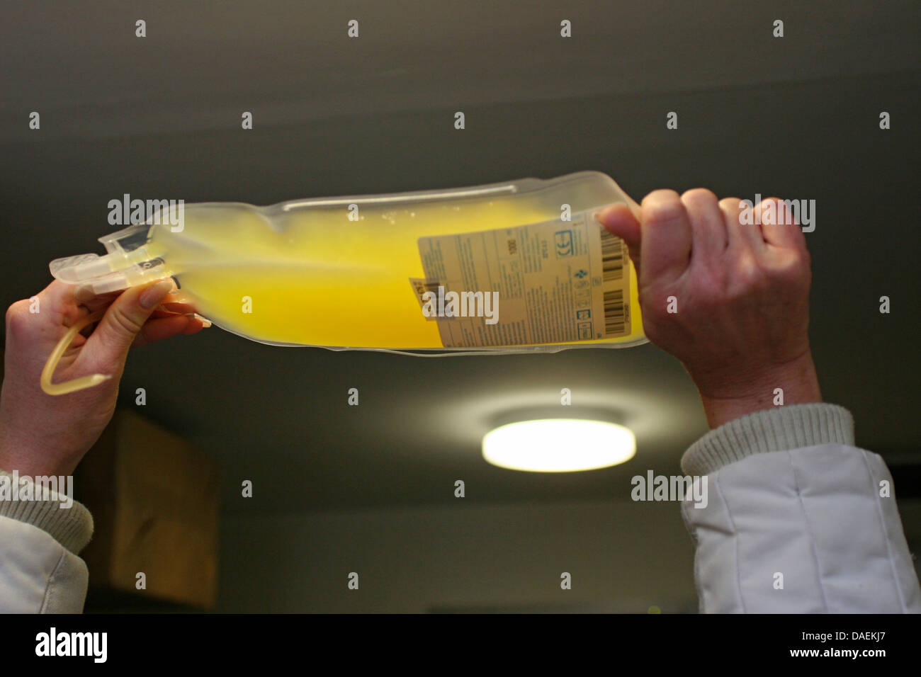 La sacca di plasma sanguigno concentrato essendo trattenuto contro una luce a soffitto Foto Stock