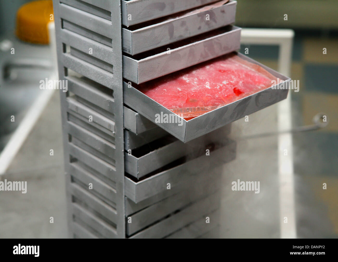 Cavo di cellule staminali;sangue congelato;medicina; Foto Stock