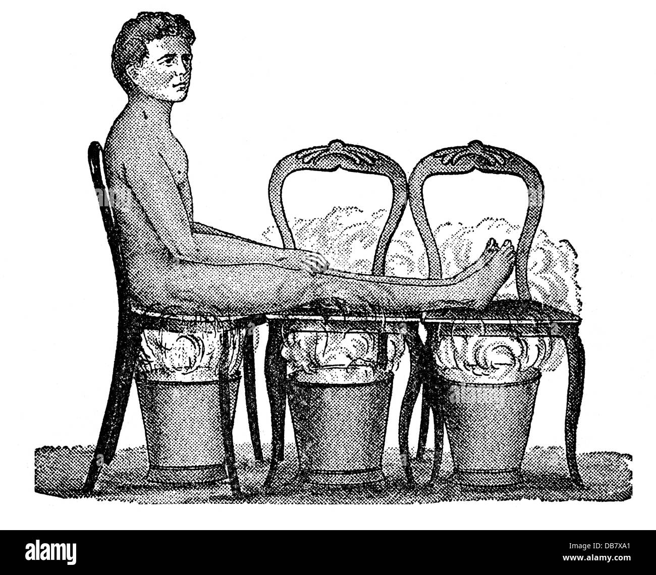 Medicina, trattamento, bagni di vapore, sedia di canna bagno di vapore per seduta, incisione in legno, da: Friedrich Eduard Bilz, New Naturopathic Treatment, Leipzig, Germania, 1902, diritti aggiuntivi-clearences-non disponibile Foto Stock