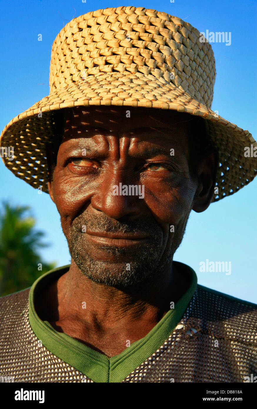 Strano Uomo Africano Infantile Con Storpe E Barba Che Fa La Faccia