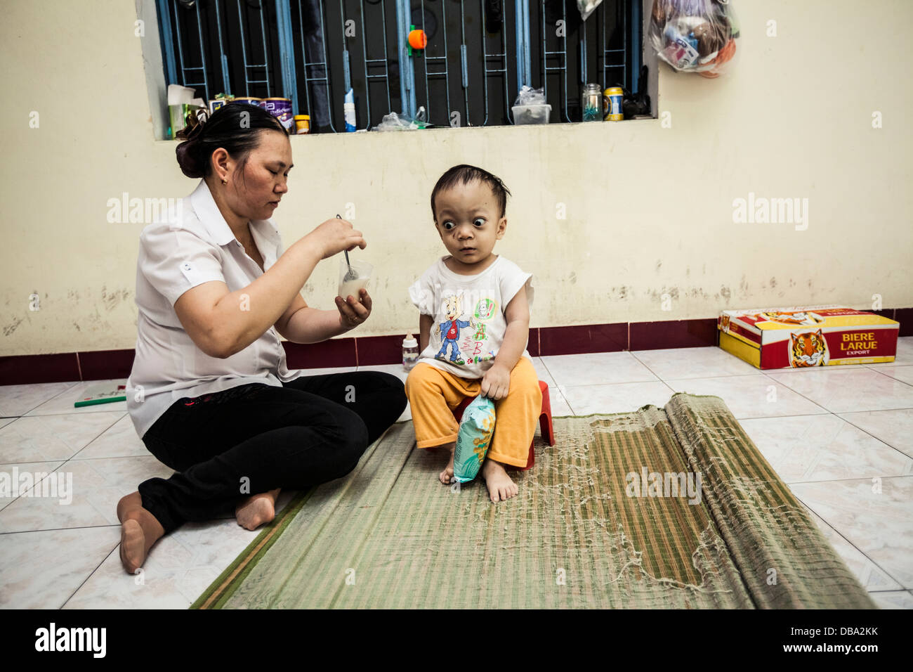 Una madre e suo figlio che soffre degli effetti dell'agente arancio, in Danang, Vietnam. Foto Stock