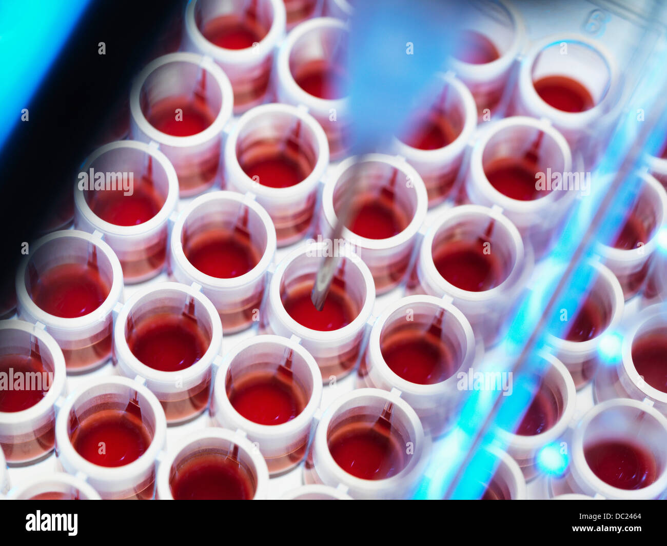 Automatizzato di screening del sangue Foto Stock