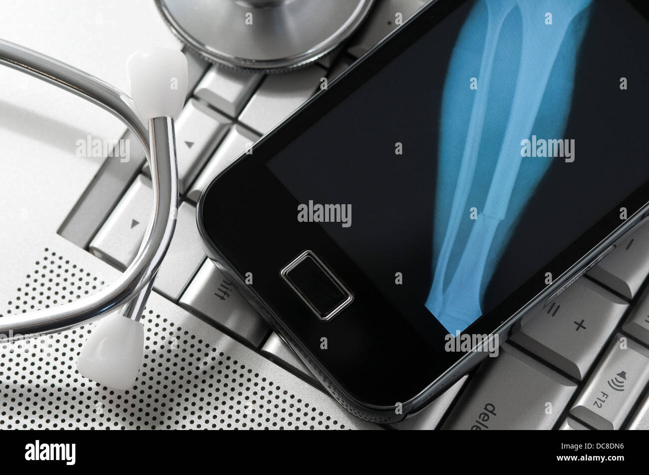 Raggi X della gamba rotta osso sulla schermata dello smartphone Foto Stock