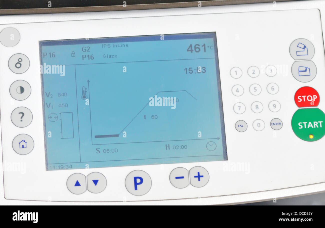 Odontoiatria forno di produzione display interno del laboratorio Foto Stock