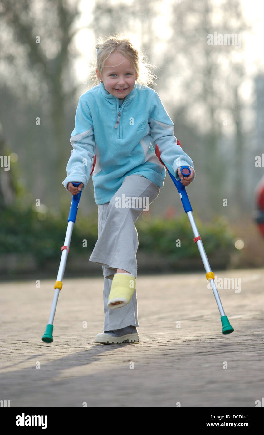 Bambina con una gamba rotta Foto Stock