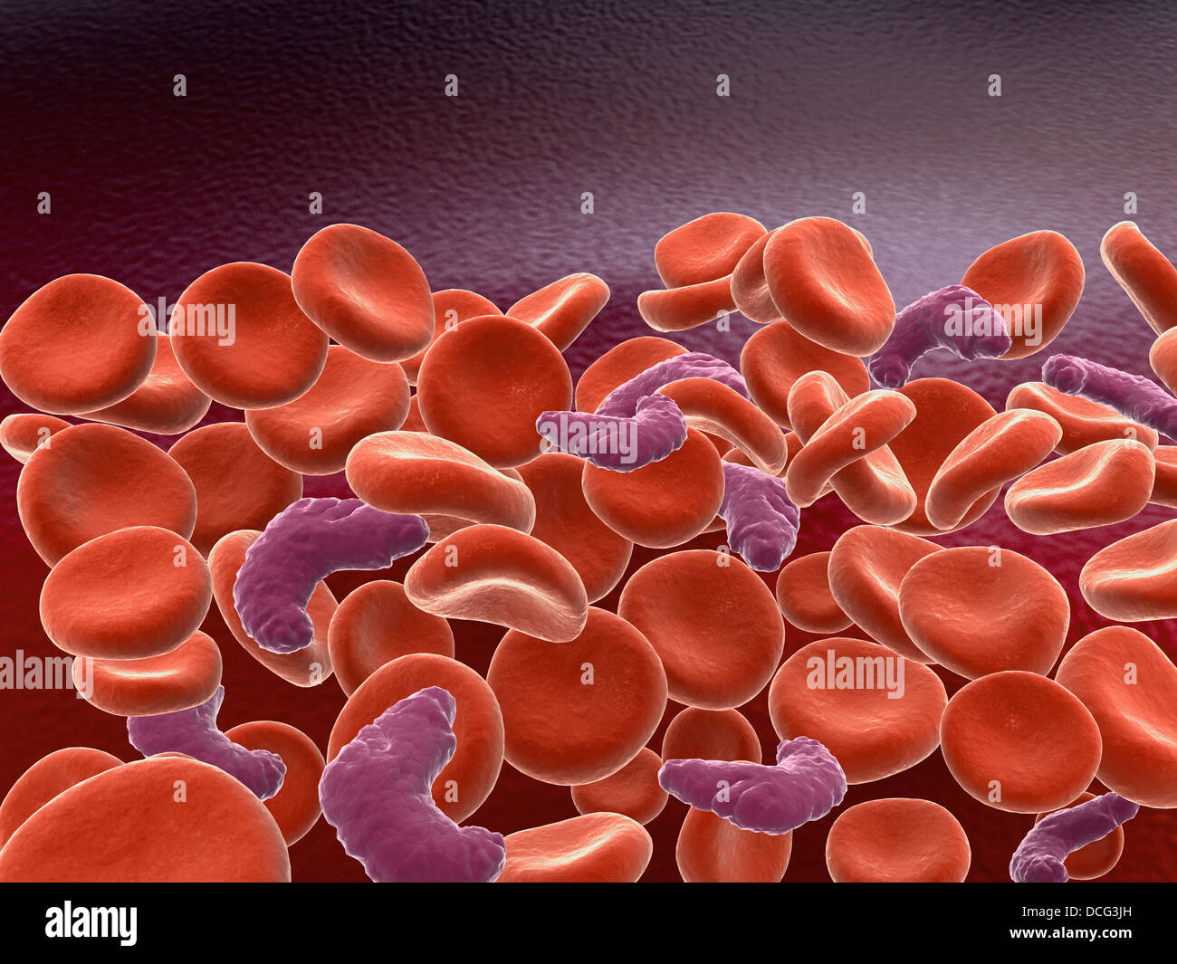Immagine concettuale di anemia falciforme con le cellule rosse del sangue. Foto Stock