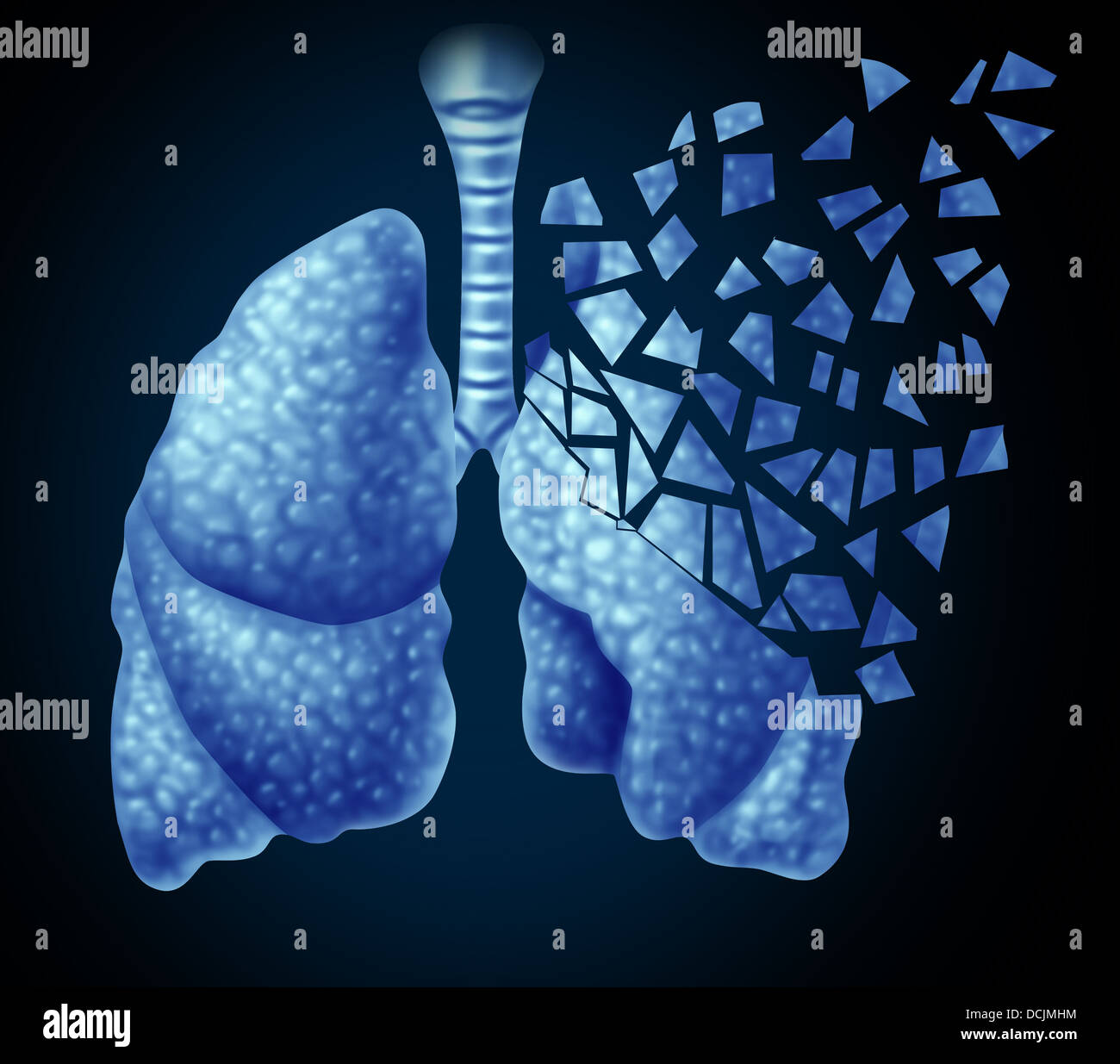 Malattia polmonare e perdere i polmoni umani health care nozione come un declino della funzione respiratoria causata da cancro o malattia come la Foto Stock