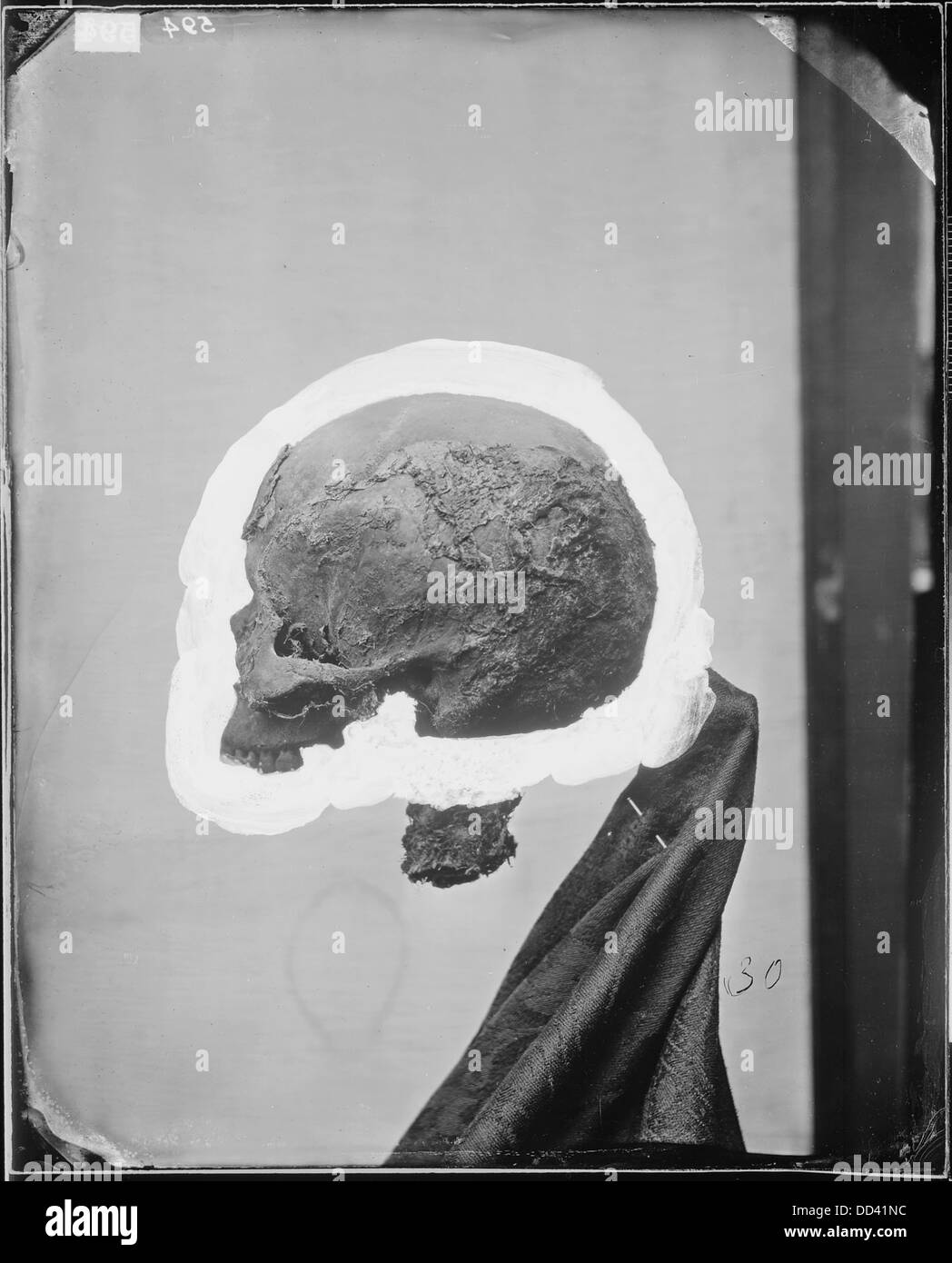 Un'immagine dettagliata del lato sinistro di un cranio umano, probabilmente parte di uno studio o di una visualizzazione anatomica, che mostra la struttura e le caratteristiche del cranio. Foto Stock