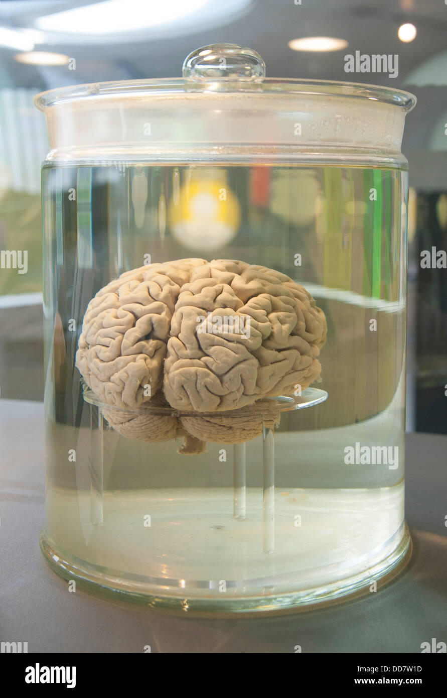 Cervello umano in un contenitore di vetro riempito con un fluido chiaro Foto Stock