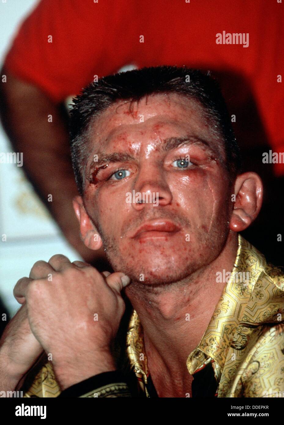Italo-tedesca boxer Graciano Rocchigiani con un battuto di fronte dopo i campionati del mondo combattere in cruiser peso contro il tedesco Henry Maske il 27 maggio nel 1995 a Monaco di Baviera. Foto Stock