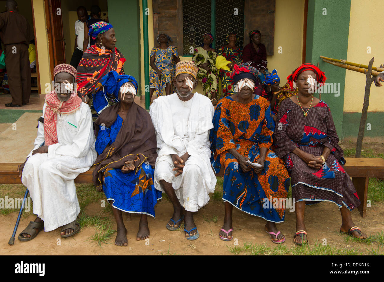 Pazienti trattati per la cataratta in una clinica medica in Otutulu, Nigeria Foto Stock