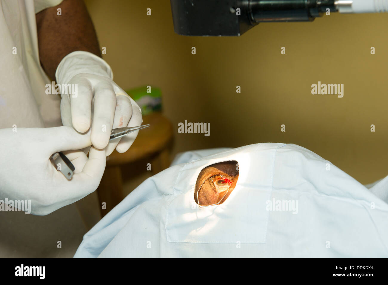 Un oculista pratiche di chirurgia della cataratta in clinica mobile Foto Stock
