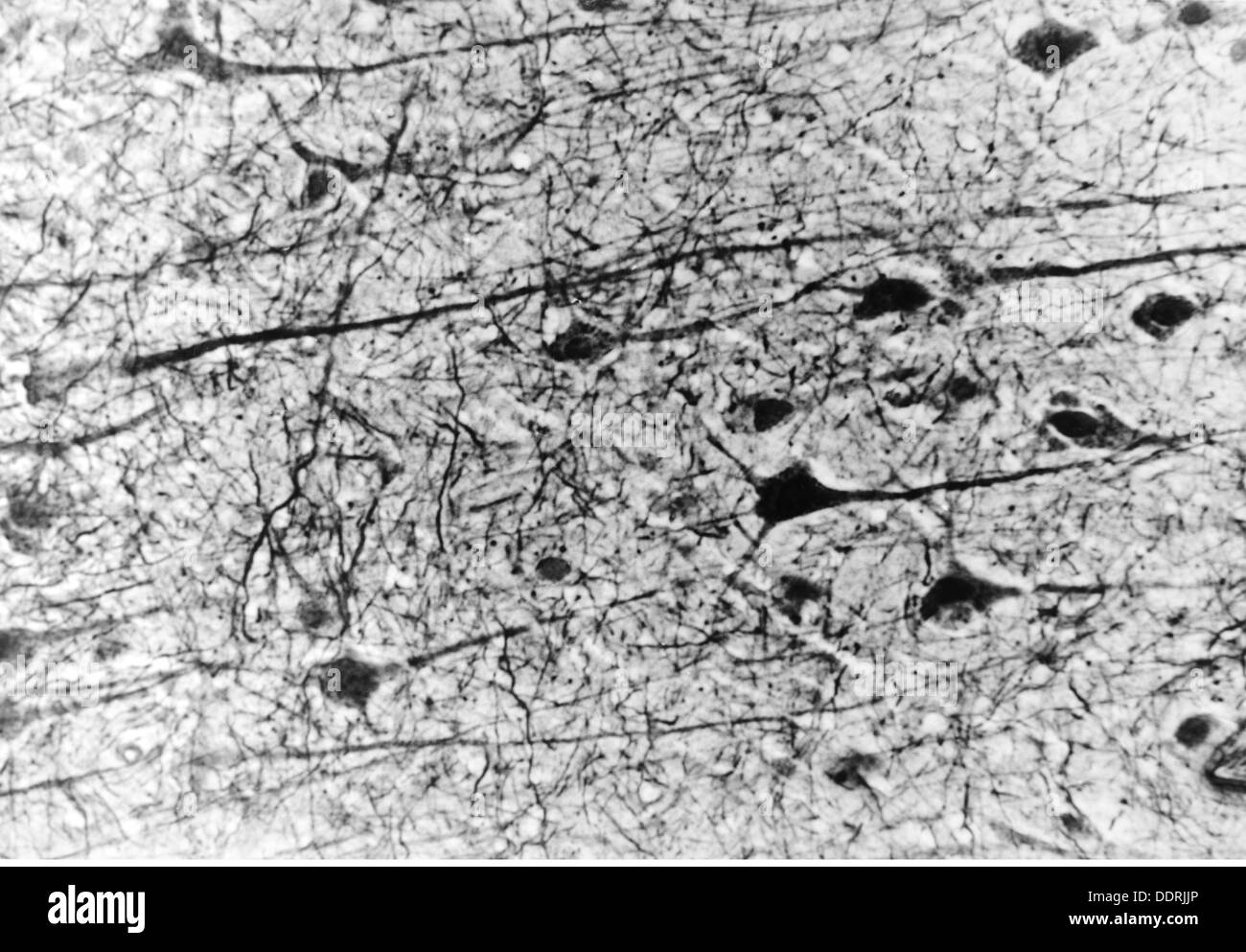 Medicina, anatomia, cerebrico / cranio, cortici del cerebrio umano, cellule piramidali, foto del Dr. Adelheid Winkelmann, 20 ° secolo, 20 ° secolo, microscopia, cellula nervosa, cellule nervose, neurale, neuritica, via nervosa, tratto nervoso, vie nervose, tratti nervosi, corteccia cerebrale, cellula piramidale, medicina, farmaci, storico-ulteriori diritti non disponibili Foto Stock