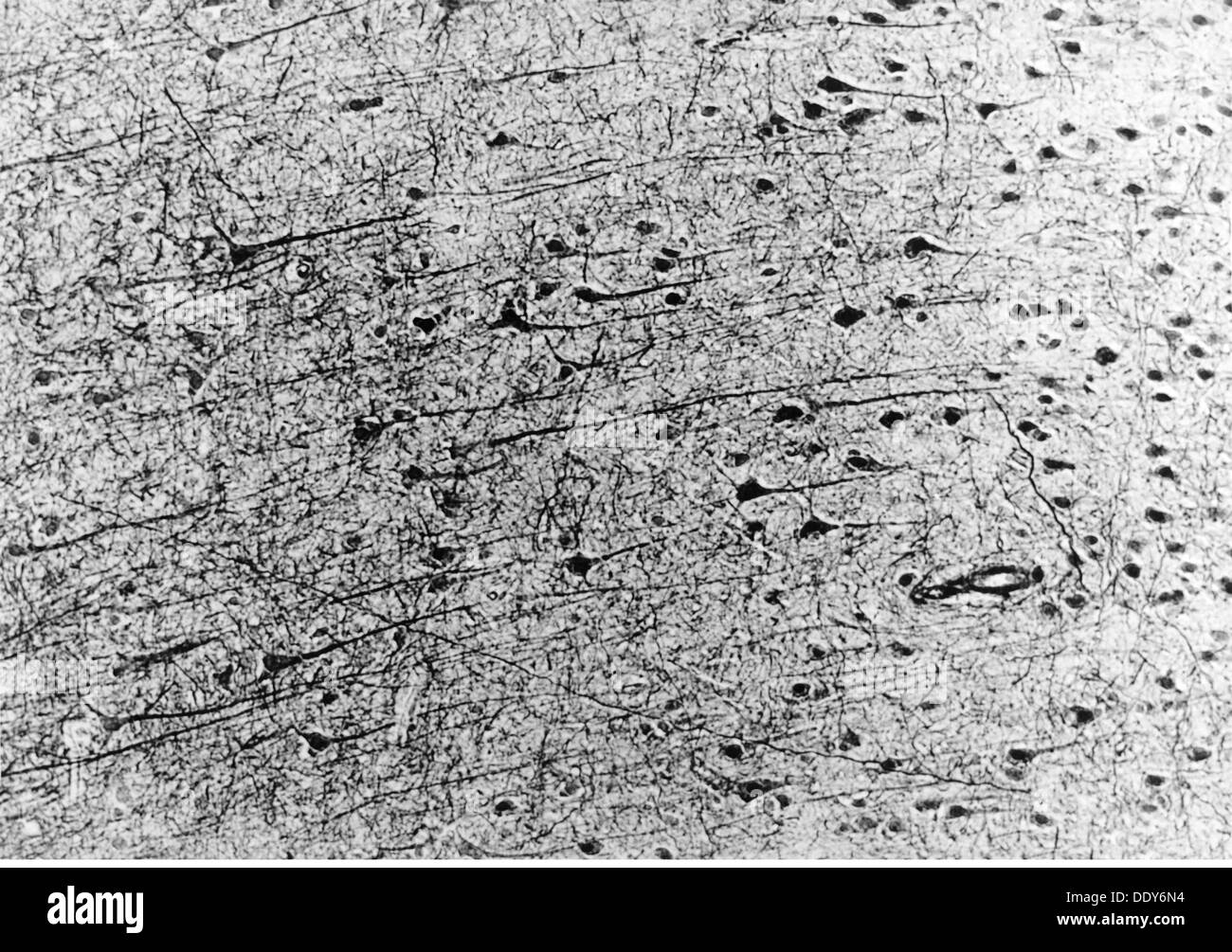 Medicina, anatomia, cerebrico / cranio, cortici del cerebrio umano, cellule piramidali, foto del Dr. Adelheid Winkelmann, 20 ° secolo, 20 ° secolo, microscopia, cellula nervosa, cellule nervose, neurale, neuritica, via nervosa, tratto nervoso, vie nervose, tratti nervosi, corteccia cerebrale, cellula piramidale, medicina, farmaci, storico-ulteriori diritti non disponibili Foto Stock