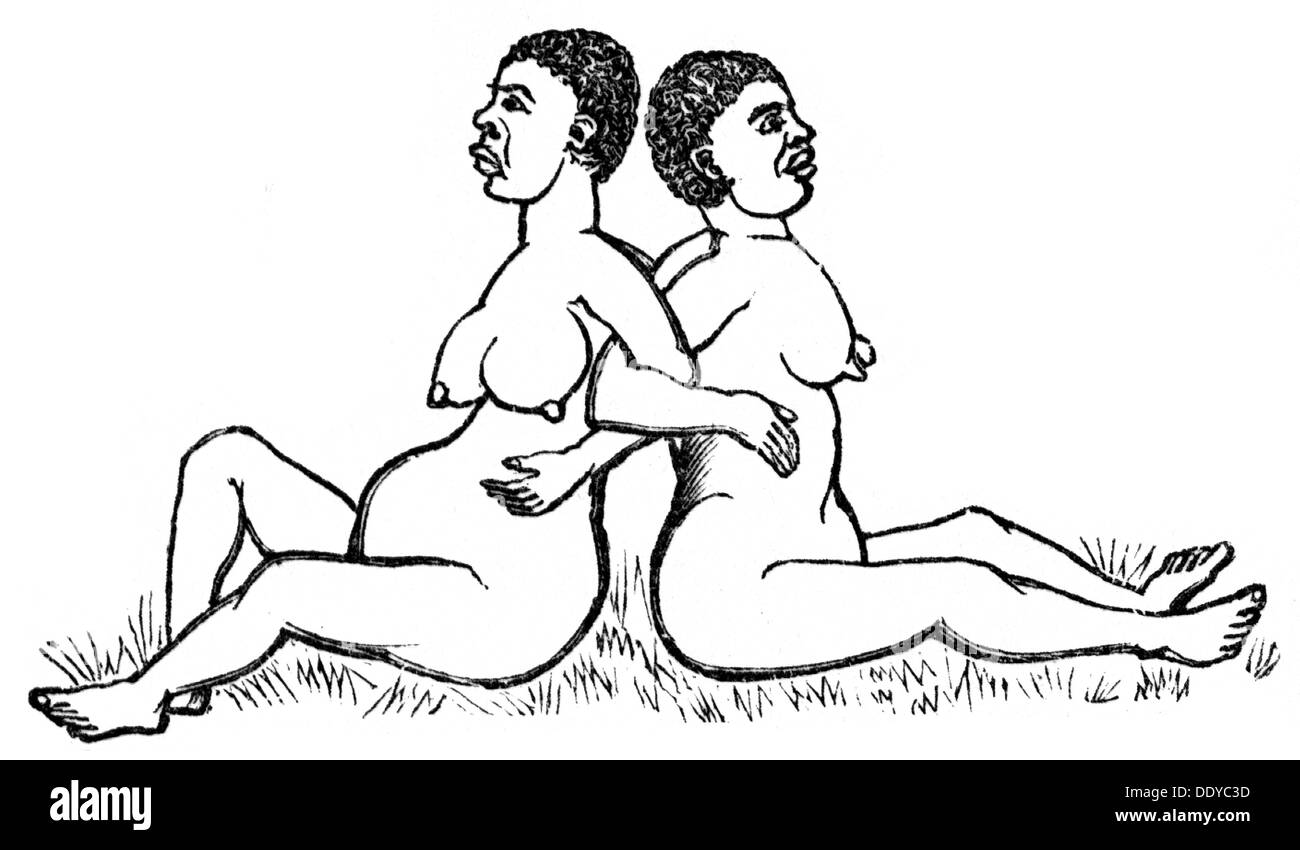 Medicina, nascita / ginecologia, donna incinta della tribù Madi durante il parto con ostetrica, Africa centrale, disegno dopo Robert Felkin (1853 - 1926), circa 1900, diritti aggiuntivi-clearences-non disponibile Foto Stock