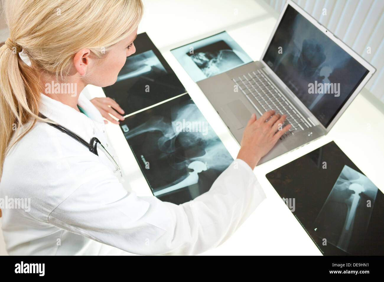 Una donna bionda medico cerchi a raggi x di anca e utilizzo di computer portatile in un ospedale Foto Stock
