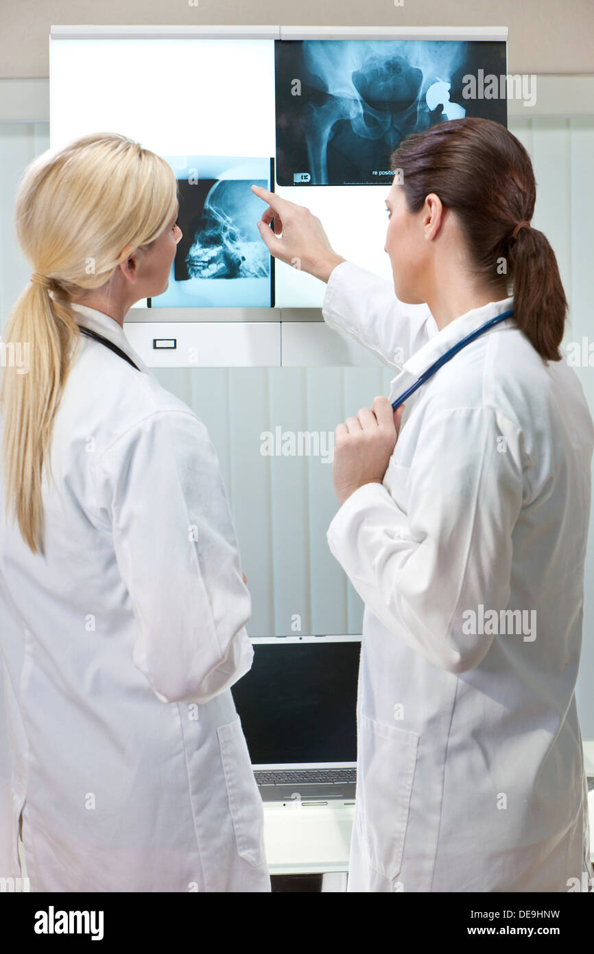 Due femmina medici cerchi a raggi x di anca e il cranio durante l'utilizzo di laptop in un ospedale Foto Stock