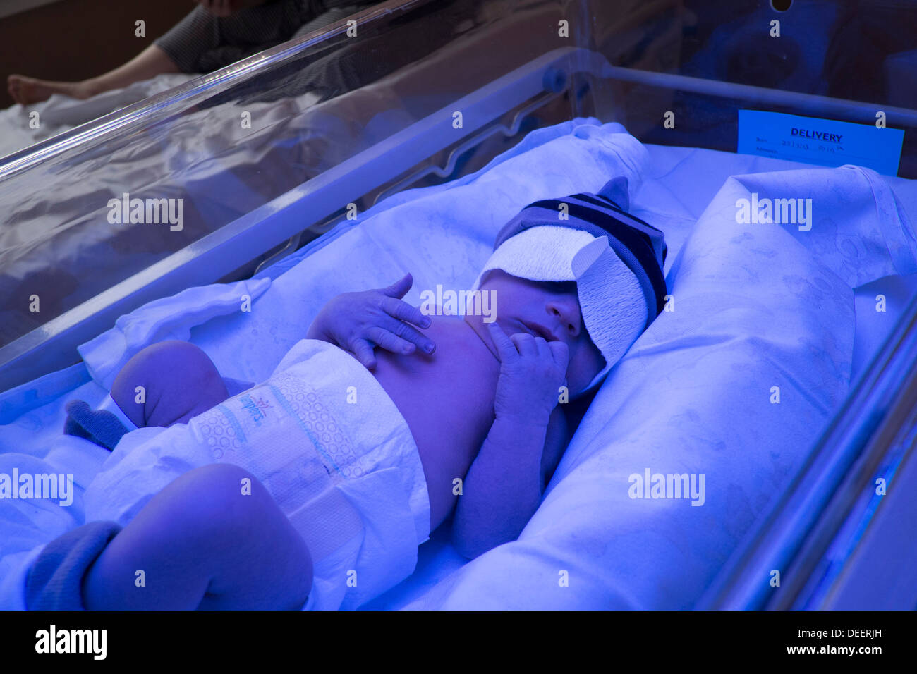 Un neonato boy getting trattate per ittero sotto una lampada per  fototerapia Foto stock - Alamy
