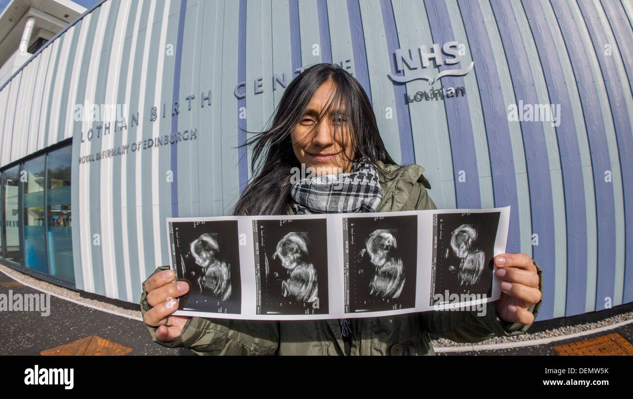 Baby la scansione di fotografie e madre in stato di gravidanza Foto Stock
