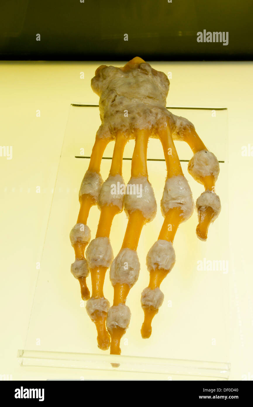 Plastination campione di ossa e articolazioni della mano Foto Stock