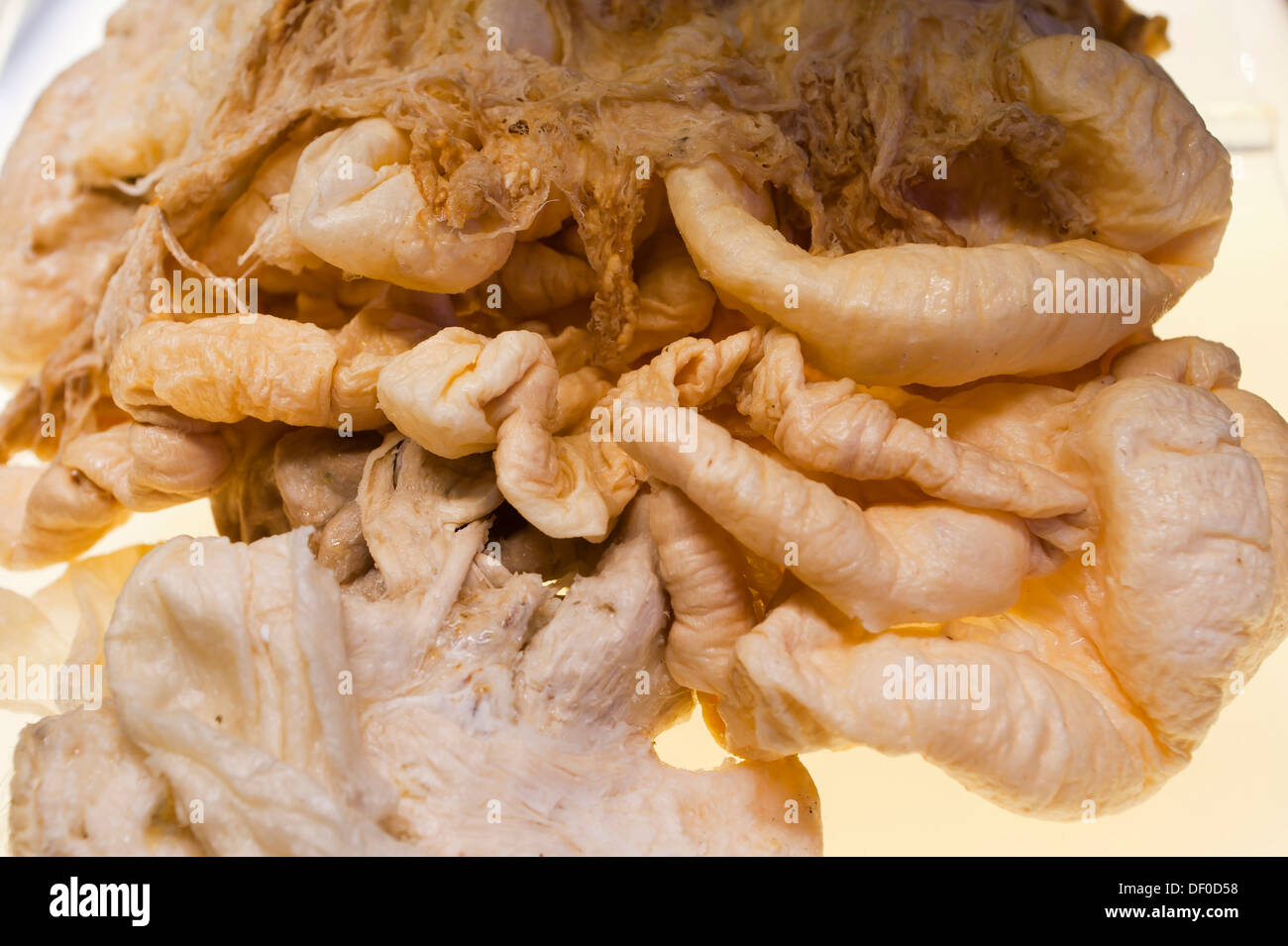 Plastination esemplare del sistema digestivo Foto Stock