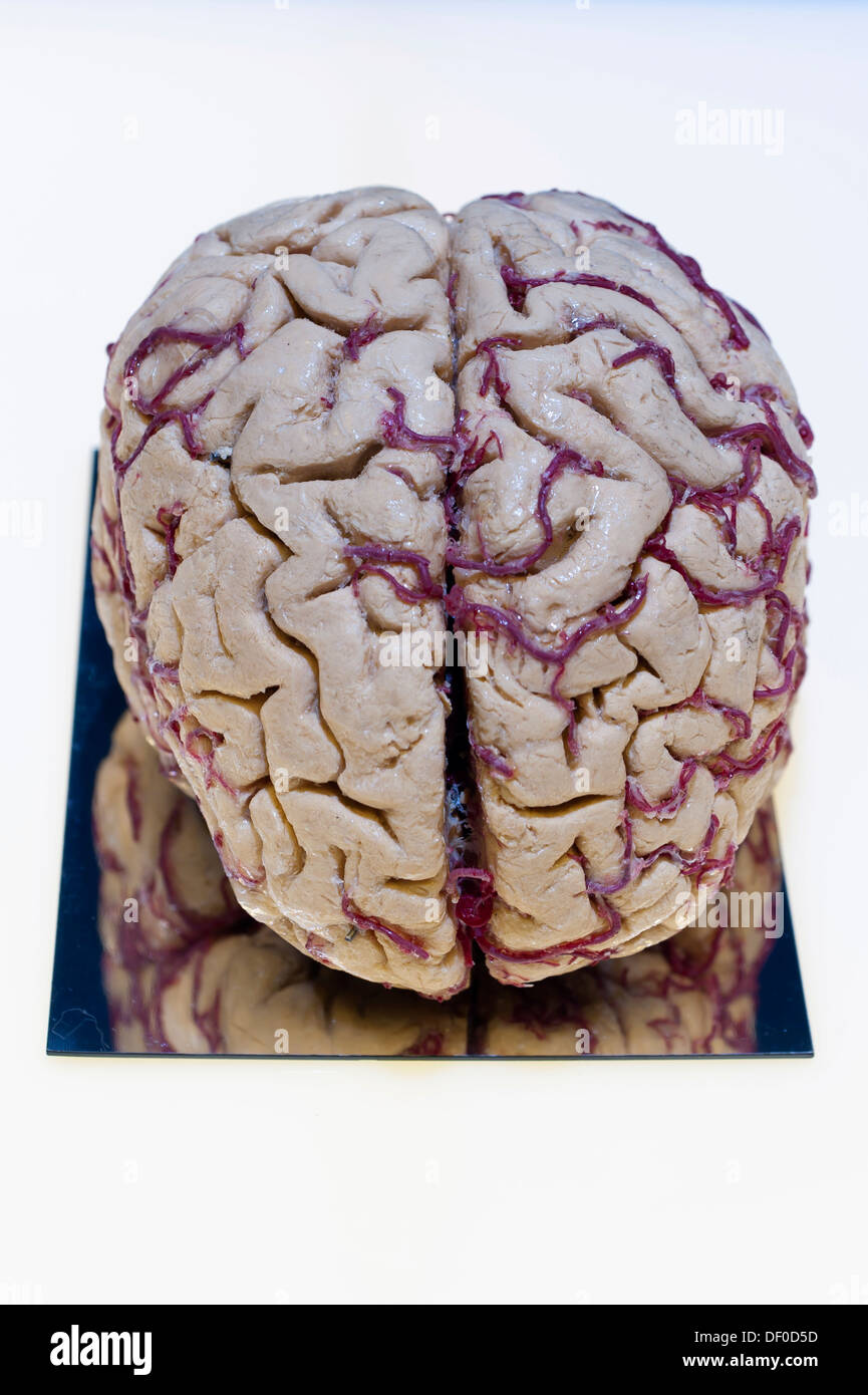 Plastination esemplare del cervello Foto Stock