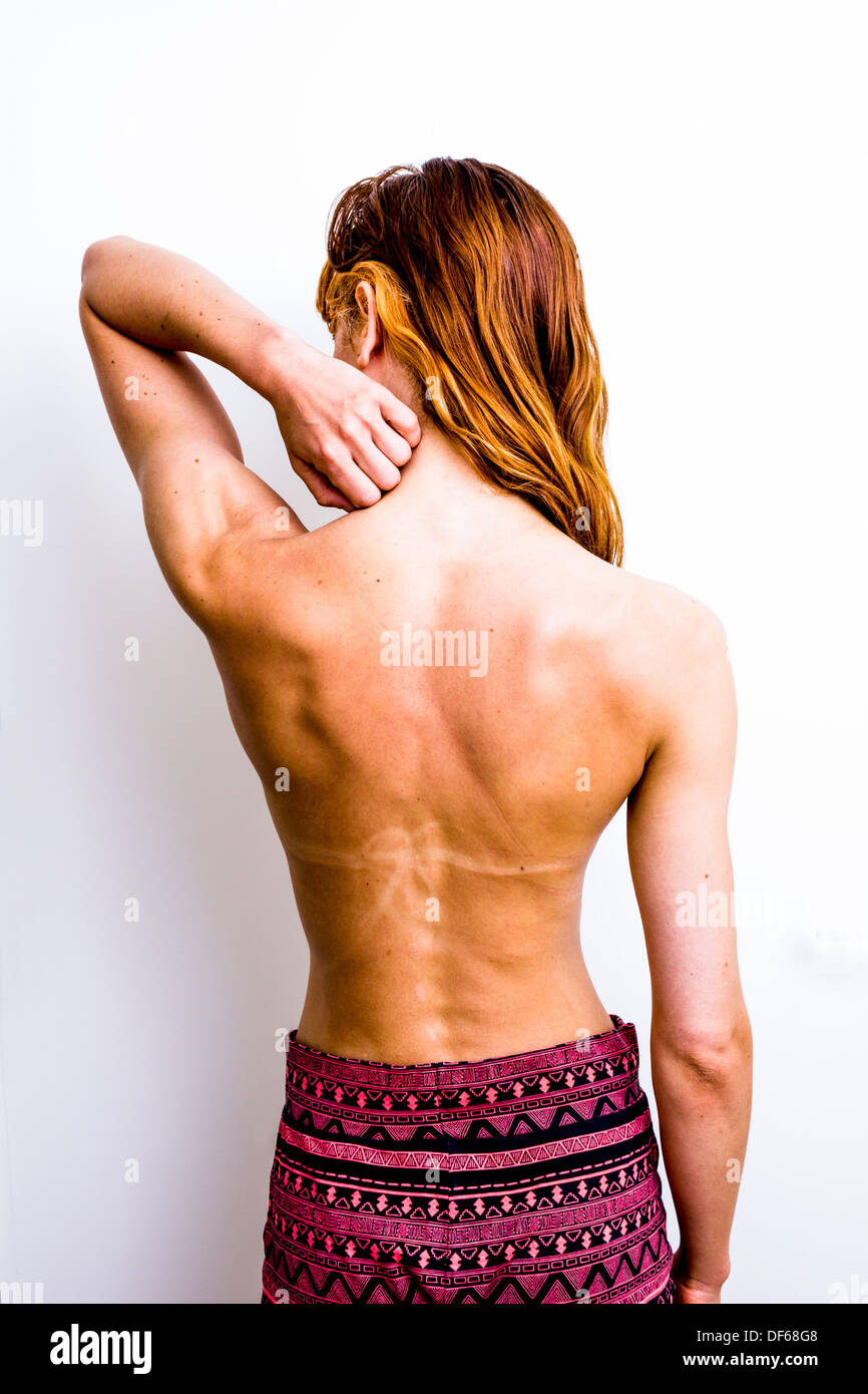 Vista posteriore del colpo di una giovane donna con tan linee sulla sua schiena da prendere il sole Foto Stock