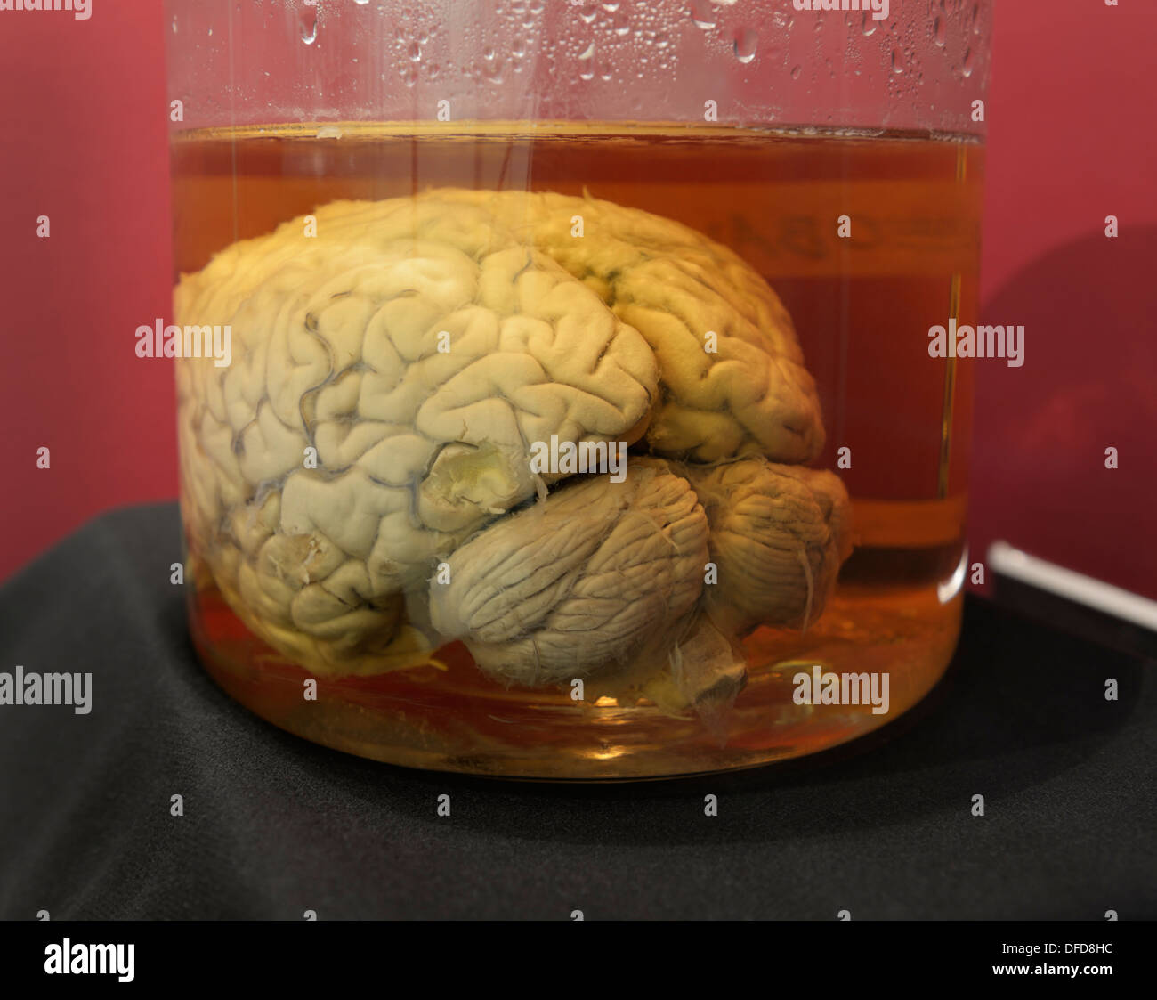Cervello umano in un vaso, Cornell University. Il cervello è parte del Wilder Raccolta del cervello Foto Stock