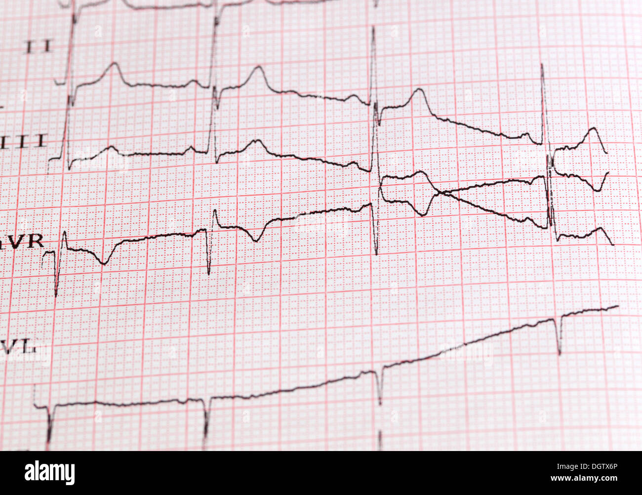 Il cardiogram foto su carta Foto Stock