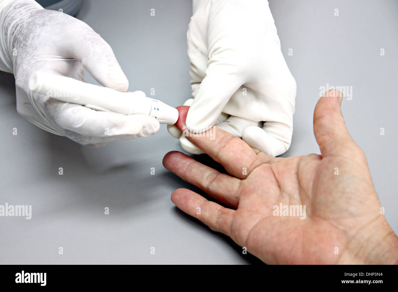 L'immagine i prelievi di sangue a portata di mano e di rilevare le anomalie. Foto Stock