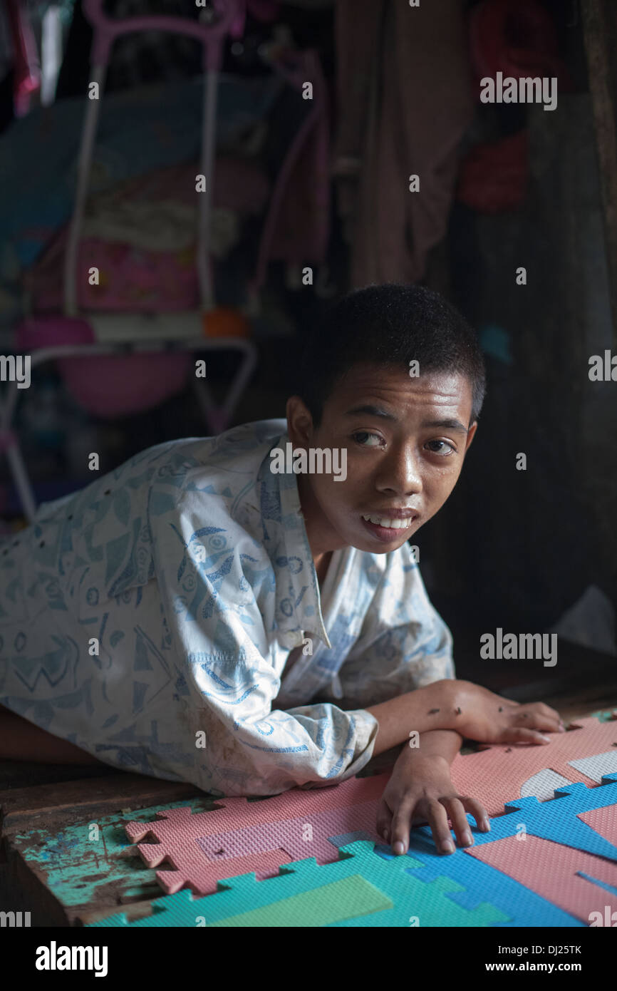 Ragazzo giovane sfigurato poveri Bali sfidato la povertà estrema tenere poveri standard a soffietto Indonesia 29 Casa condizioni dura sporca i Foto Stock
