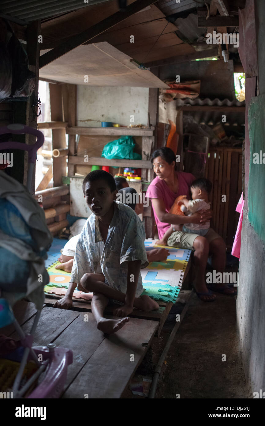 Bambini sfigurati famiglia storpi poveri Bali sfidato la povertà estrema povertà standard a soffietto Indonesia 29 Casa hars condizioni Foto Stock