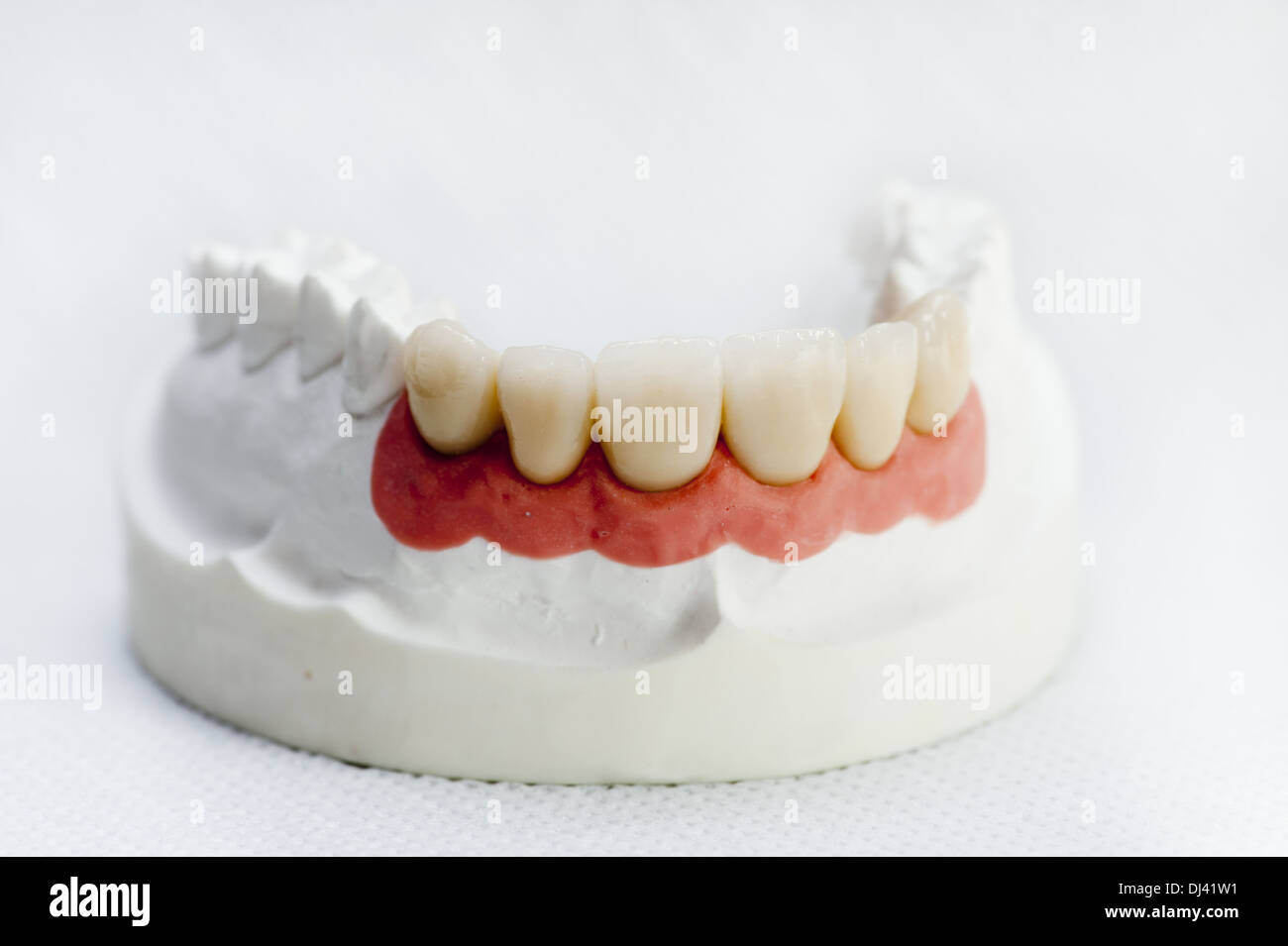 Denti artificiali nel modello di ganascia Foto Stock