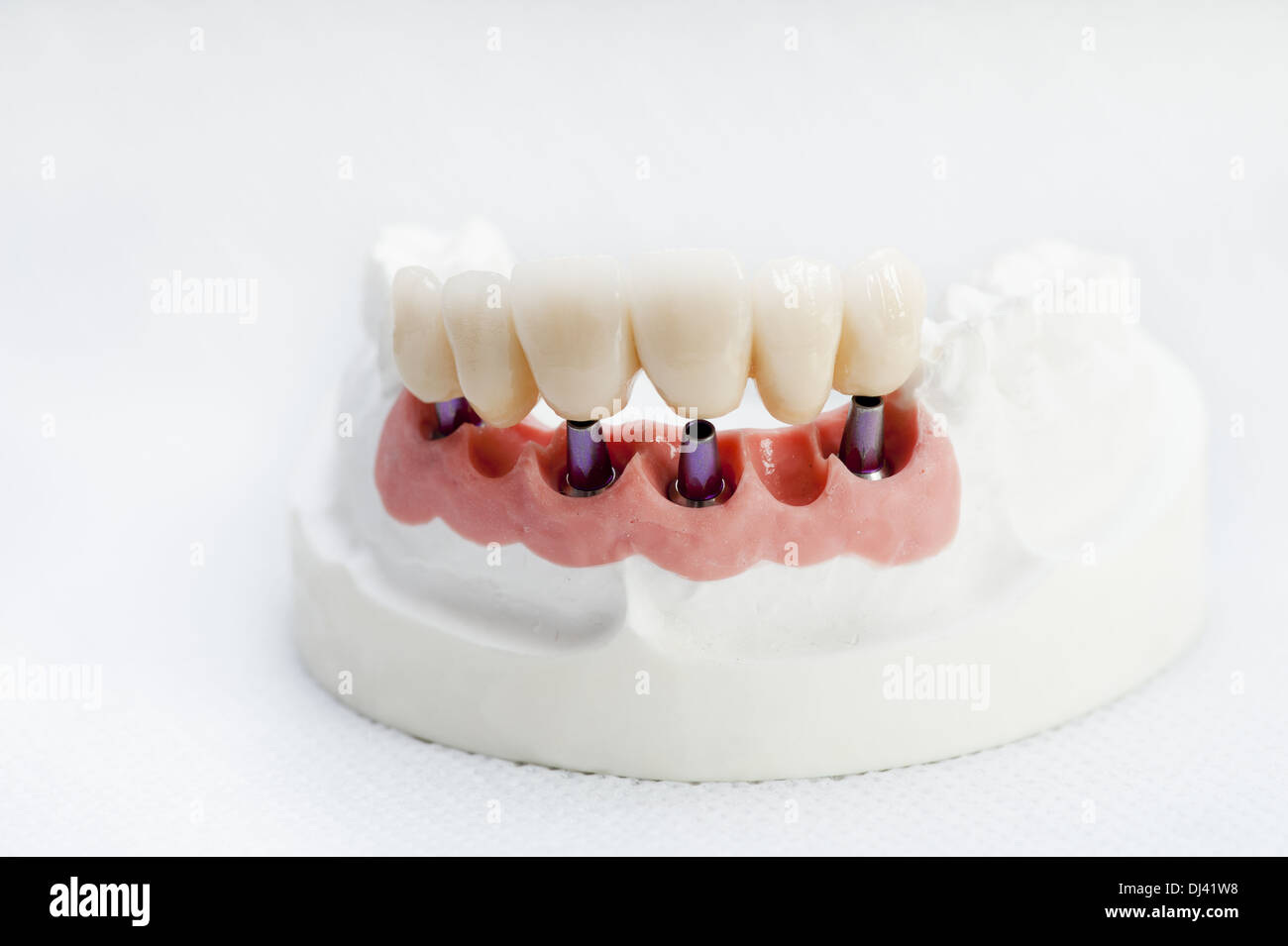 Parti della dentizione Foto Stock