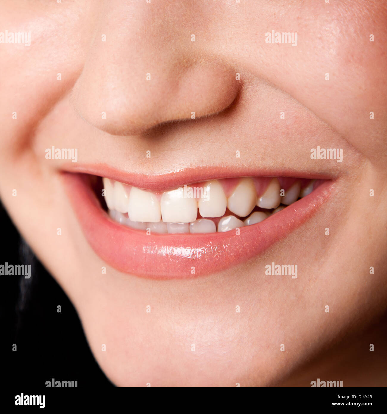 Bella denti in un sorriso perfetto Foto Stock