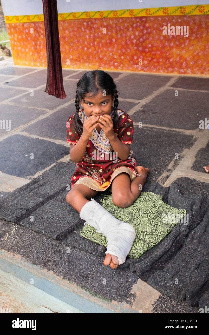 Ragazza indiana con la gamba rotta di mangiare fuori la sua rurale villaggio indiano home. Andhra Pradesh, India Foto Stock