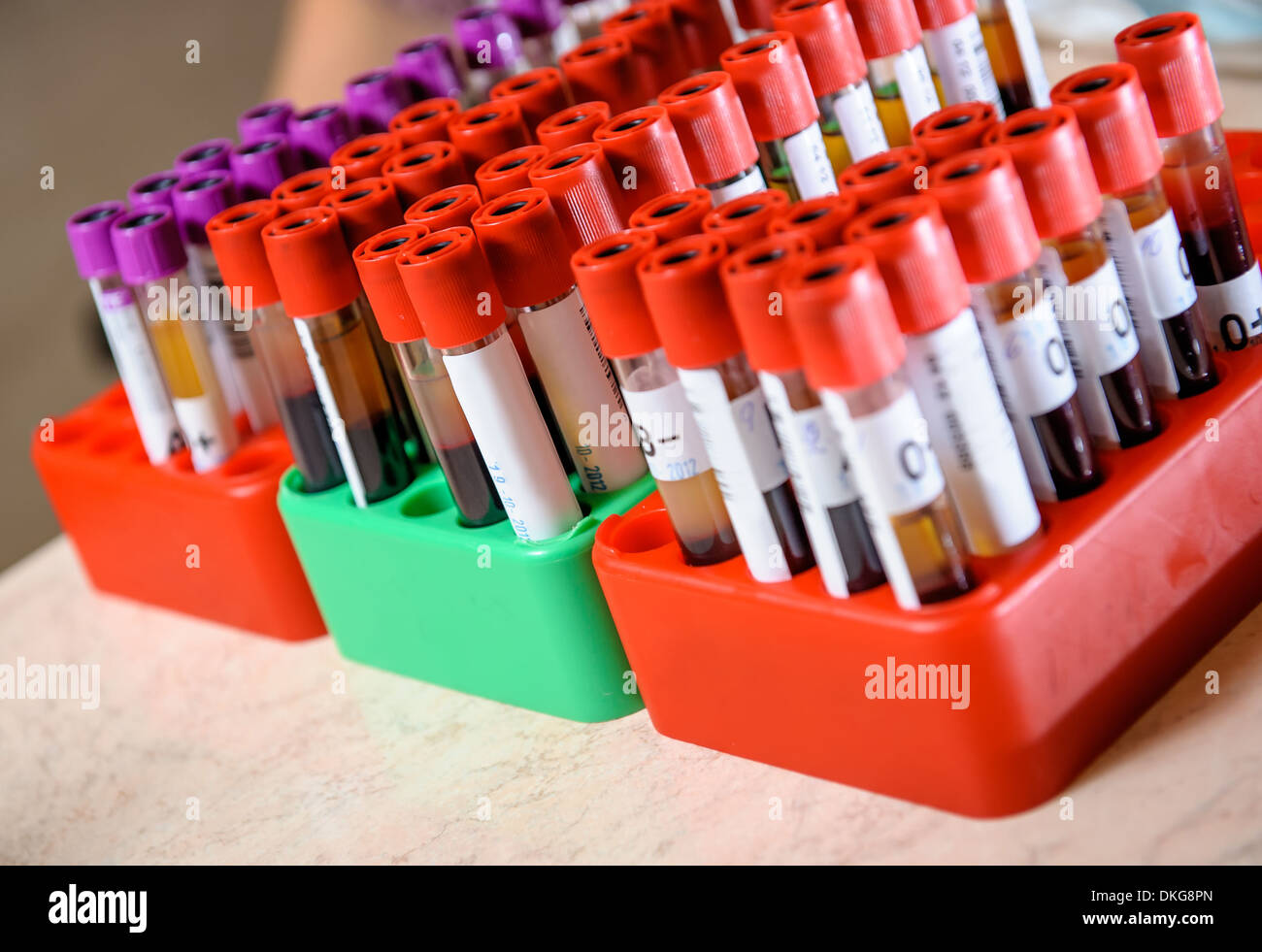 Medical provetta con i campioni di sangue Foto Stock
