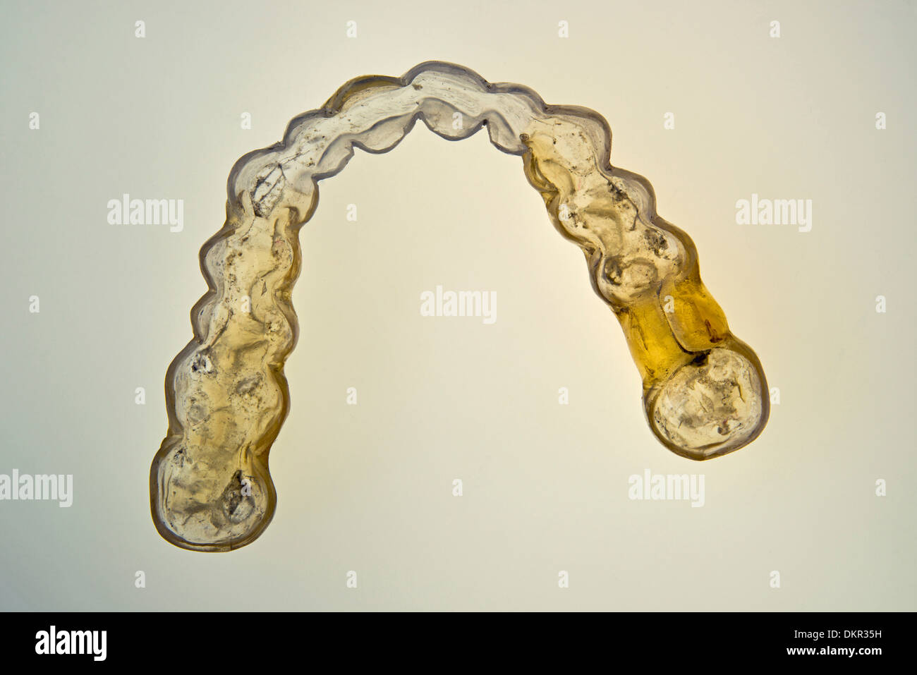 Usurati bite stecca guardia notturna splint occlusale denti dentatura rampa muscolatura da masticare acilici artificiale di usura di plastica Foto Stock
