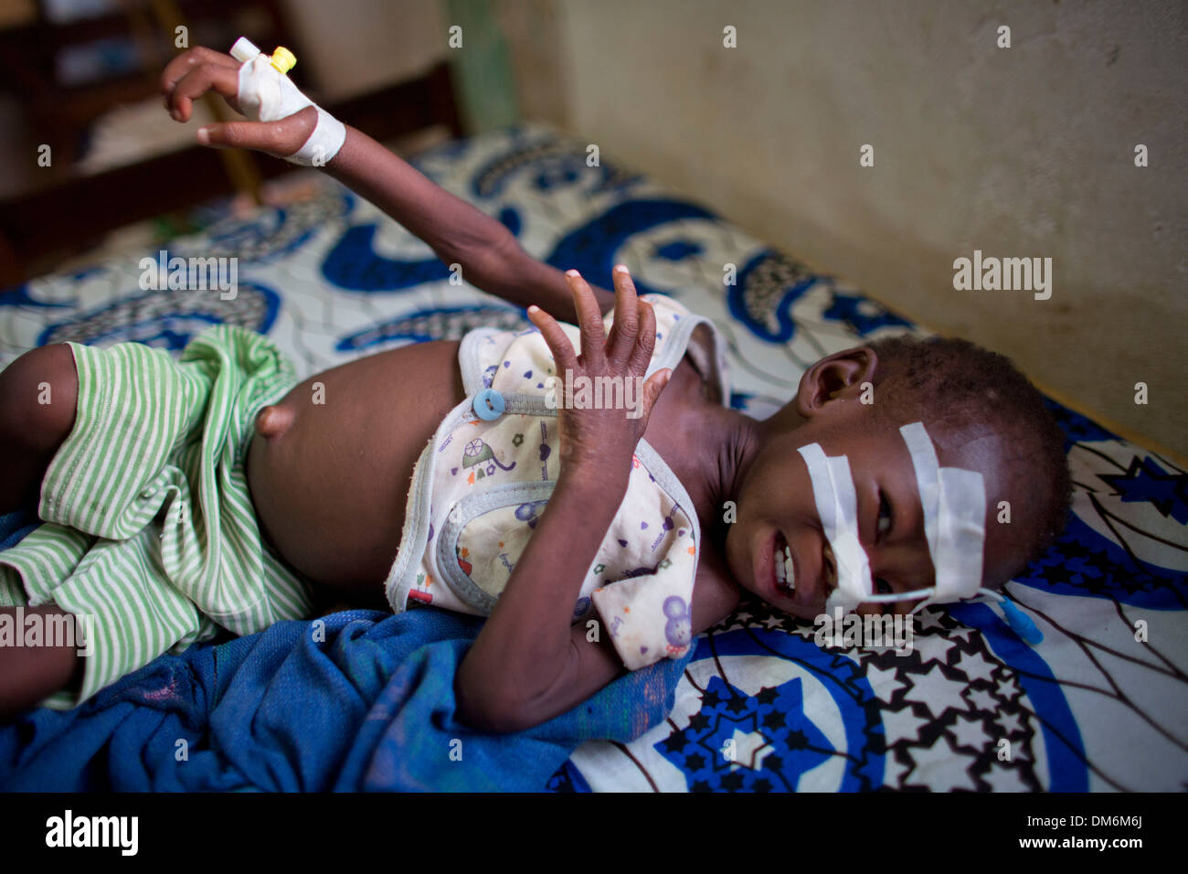 Bambini malnutriti all ospedale di MSF in Repubblica centrafricana Foto Stock